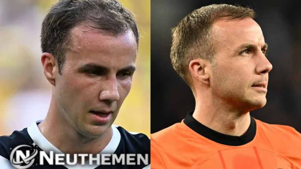 Mario Götze Haartransplantation – Alles über seine Haarverpflanzung, Methode und Ergebnis Mario Götze Haartransplantation